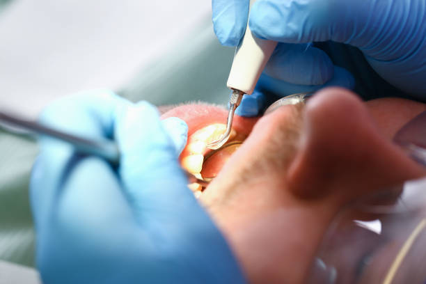Best Urgent Dental Care in Frankfort, IN