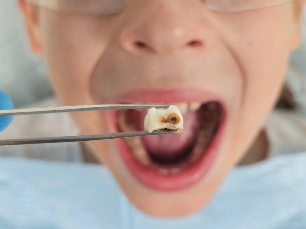 Best Emergency Dental Care for Trauma or Injury in Frankfort, IN